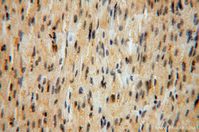 ATP6V1G1 Antibody in Immunohistochemistry (Paraffin) (IHC (P))