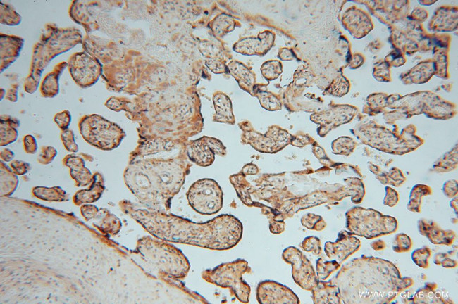 ATP6V1G1 Antibody in Immunohistochemistry (Paraffin) (IHC (P))