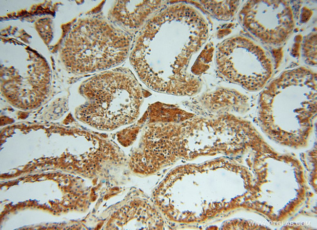 ATP6V1G1 Antibody in Immunohistochemistry (Paraffin) (IHC (P))