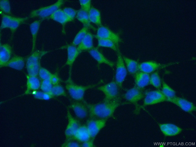 ATP6V1G1 Antibody in Immunocytochemistry (ICC/IF)