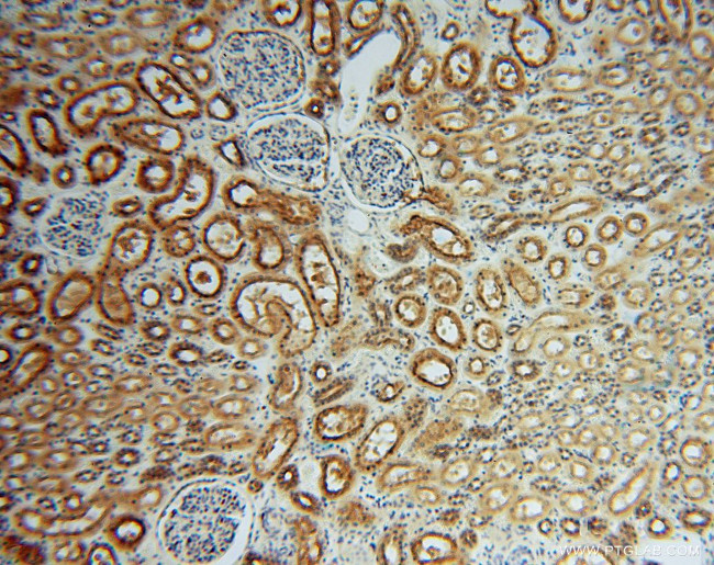 ATP6V1G1 Antibody in Immunohistochemistry (Paraffin) (IHC (P))