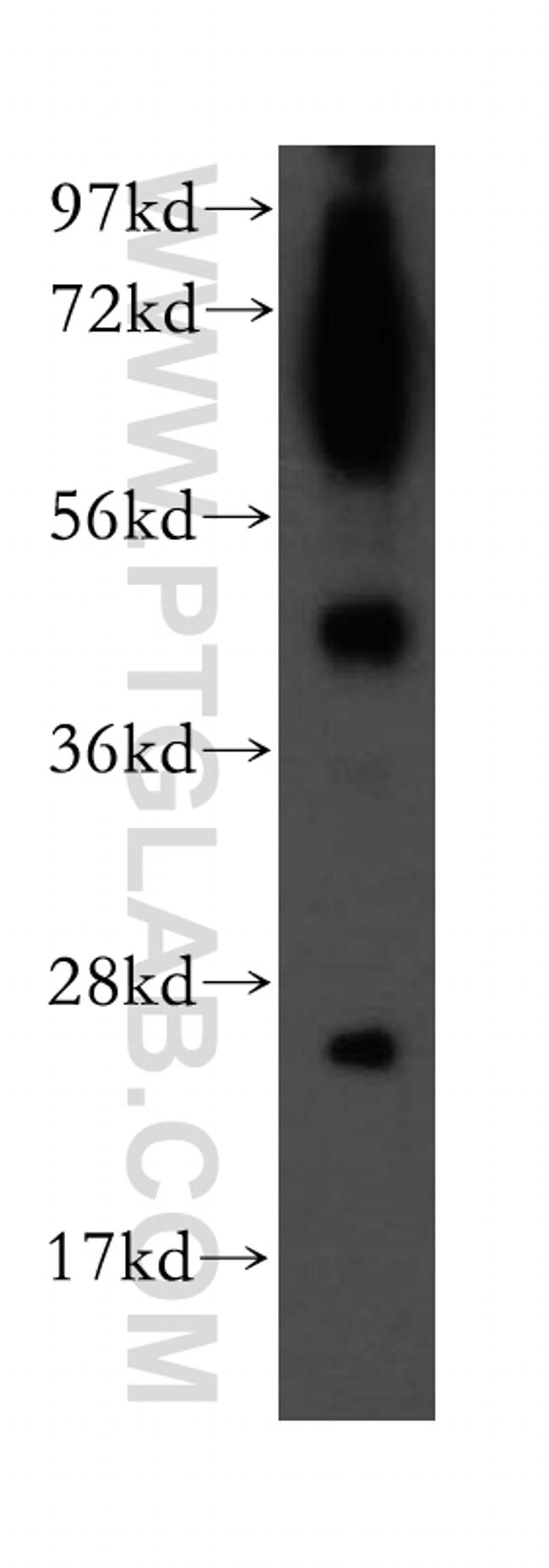 LYPLAL1 Antibody in Western Blot (WB)