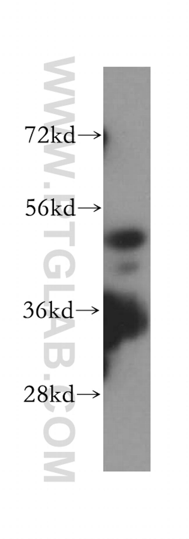 HDAC3 Antibody in Western Blot (WB)