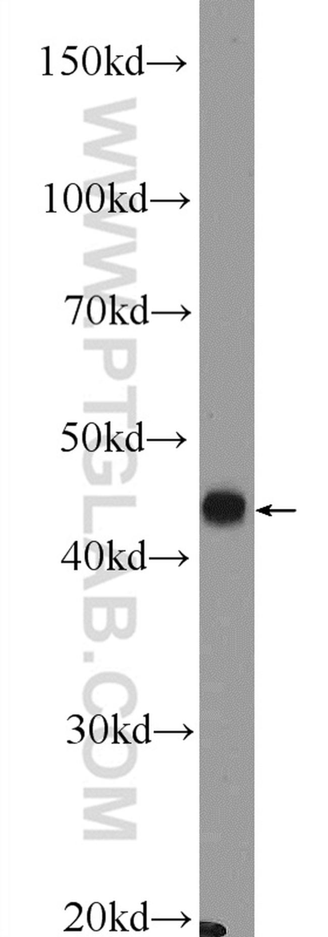 SLC30A8/ZNT8 Antibody in Western Blot (WB)