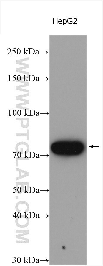 ACSS3 Antibody in Western Blot (WB)