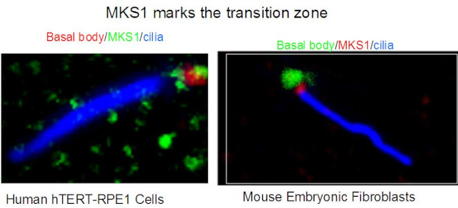 MKS1 Antibody in Immunocytochemistry (ICC/IF)