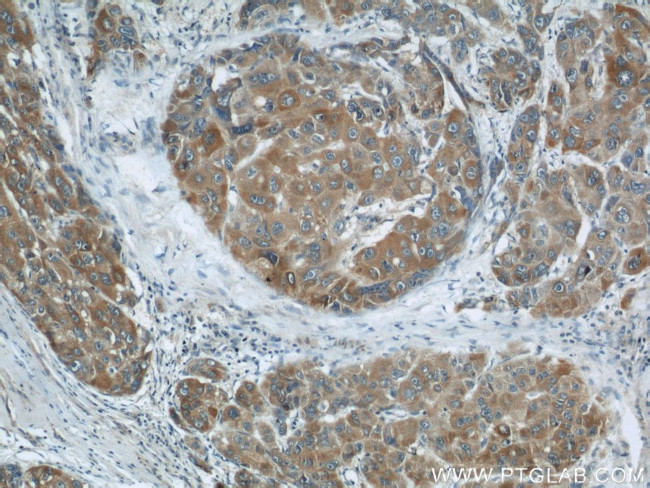 MKS1 Antibody in Immunohistochemistry (Paraffin) (IHC (P))