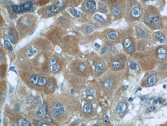 MKS1 Antibody in Immunohistochemistry (Paraffin) (IHC (P))