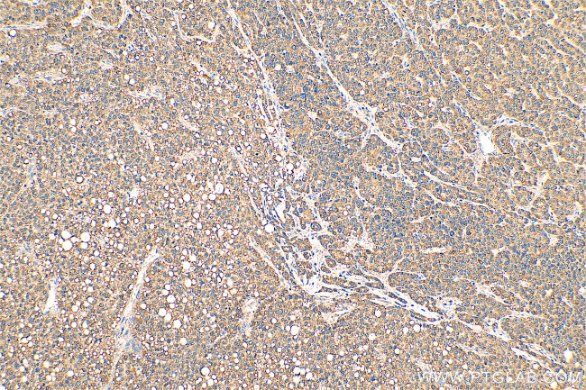 MKS1 Antibody in Immunohistochemistry (Paraffin) (IHC (P))