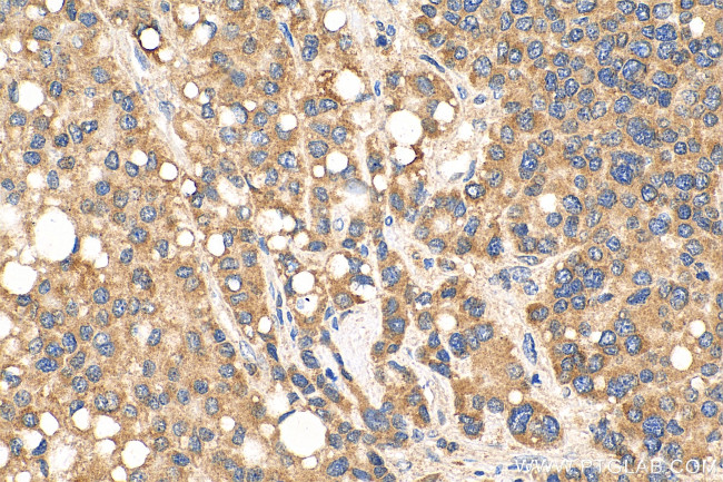 MKS1 Antibody in Immunohistochemistry (Paraffin) (IHC (P))