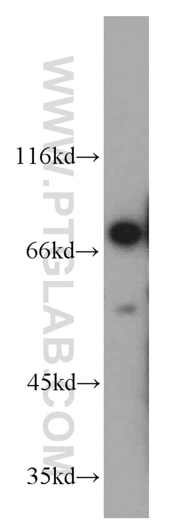 MKS1 Antibody in Western Blot (WB)