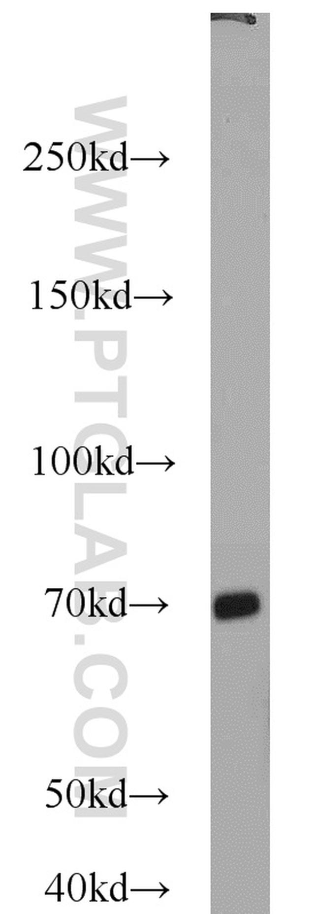 MKS1 Antibody in Western Blot (WB)