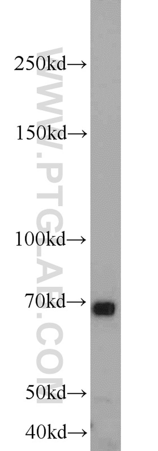 MKS1 Antibody in Western Blot (WB)