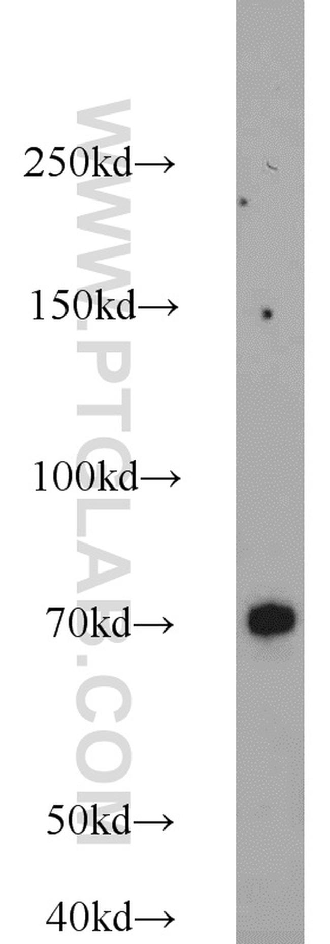 MKS1 Antibody in Western Blot (WB)