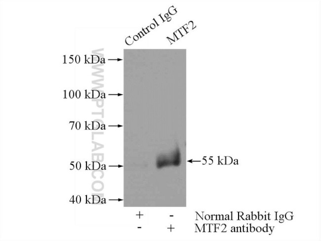 MTF2 Antibody in Immunoprecipitation (IP)