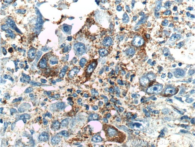 MAP3K6 Antibody in Immunohistochemistry (Paraffin) (IHC (P))