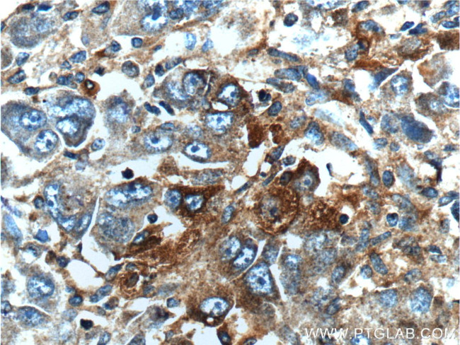 MAP3K6 Antibody in Immunohistochemistry (Paraffin) (IHC (P))