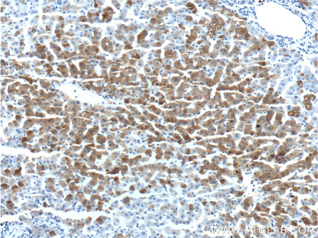 MAP3K6 Antibody in Immunohistochemistry (Paraffin) (IHC (P))