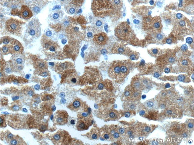 MAP3K6 Antibody in Immunohistochemistry (Paraffin) (IHC (P))