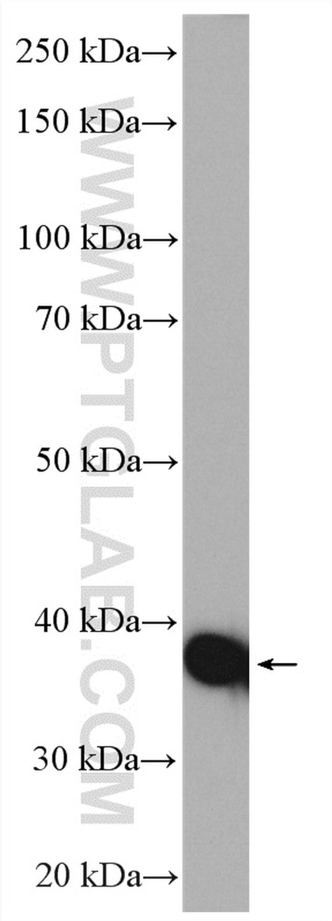 ACAT1 Antibody in Western Blot (WB)