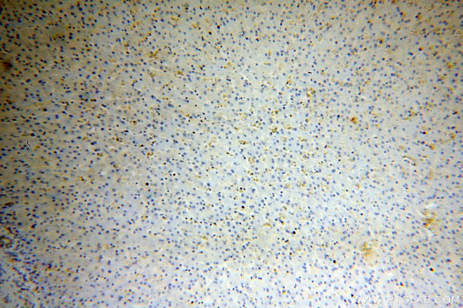 HBB Antibody in Immunohistochemistry (Paraffin) (IHC (P))