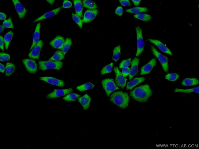 PDGFRL Antibody in Immunocytochemistry (ICC/IF)