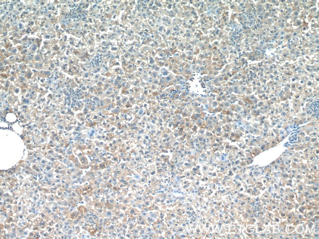 PDGFRL Antibody in Immunohistochemistry (Paraffin) (IHC (P))