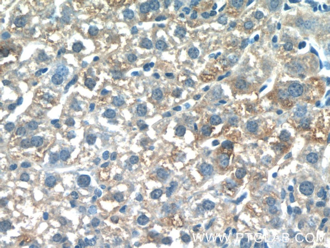 PDGFRL Antibody in Immunohistochemistry (Paraffin) (IHC (P))