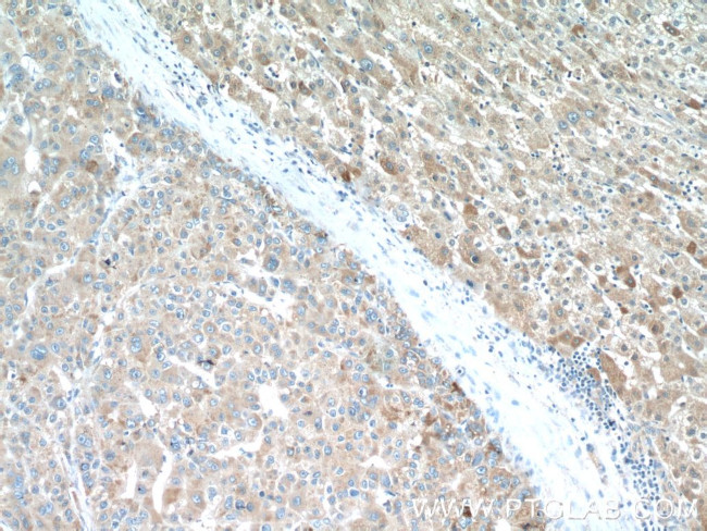 PDGFRL Antibody in Immunohistochemistry (Paraffin) (IHC (P))