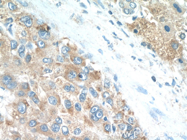 PDGFRL Antibody in Immunohistochemistry (Paraffin) (IHC (P))