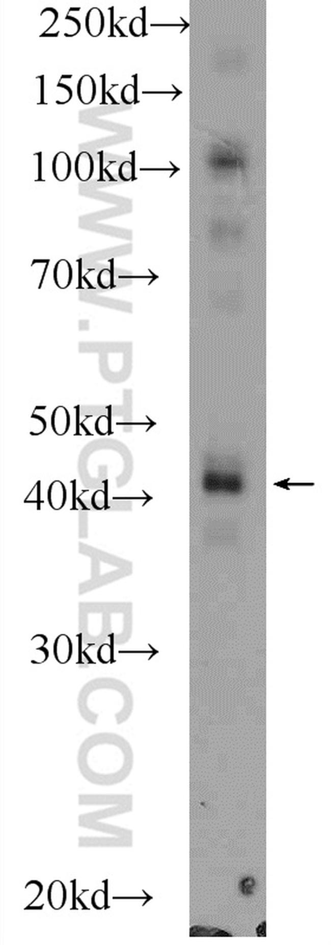 PDGFRL Antibody in Western Blot (WB)