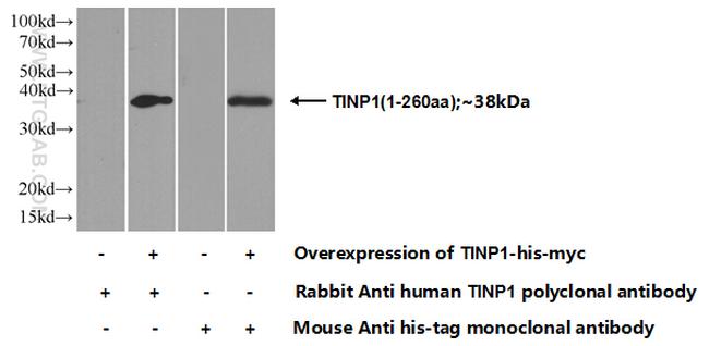 TINP1 Antibody in Western Blot (WB)