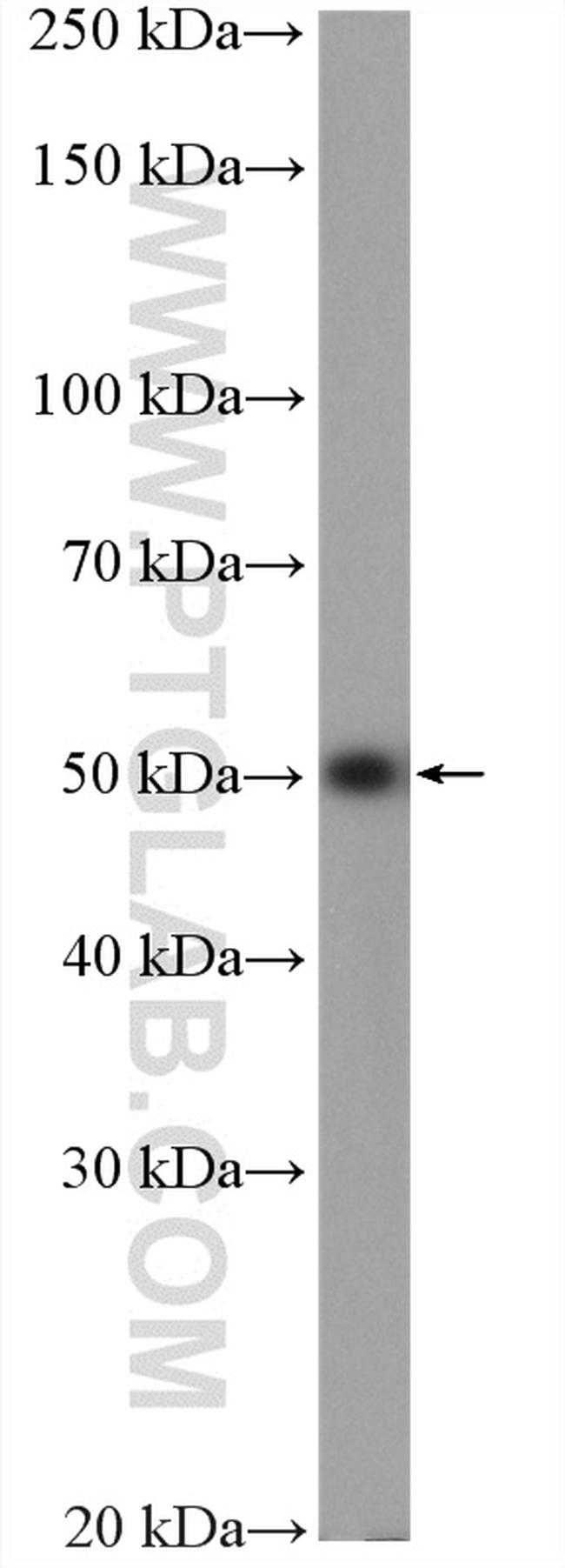 NUP54 Antibody in Western Blot (WB)