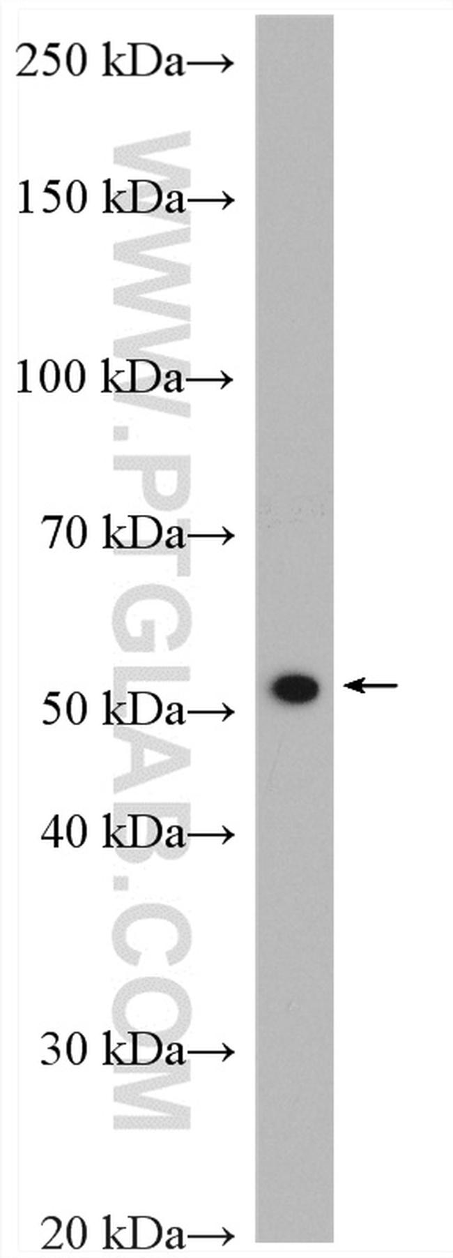 NUP54 Antibody in Western Blot (WB)