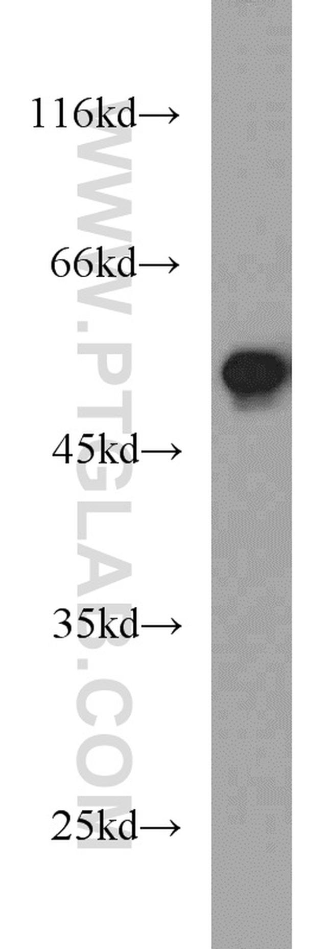 FAF2 Antibody in Western Blot (WB)