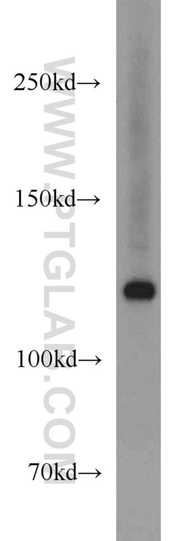 EXO1 Antibody in Western Blot (WB)