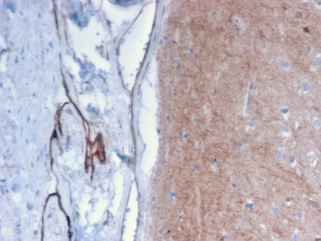 Drebrin 1 (DBN1) Antibody in Immunohistochemistry (Paraffin) (IHC (P))