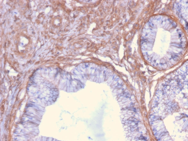 Drebrin 1 (DBN1) Antibody in Immunohistochemistry (Paraffin) (IHC (P))