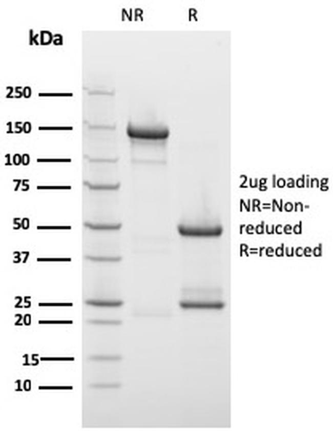 Drebrin 1 (DBN1) Antibody in SDS-PAGE (SDS-PAGE)