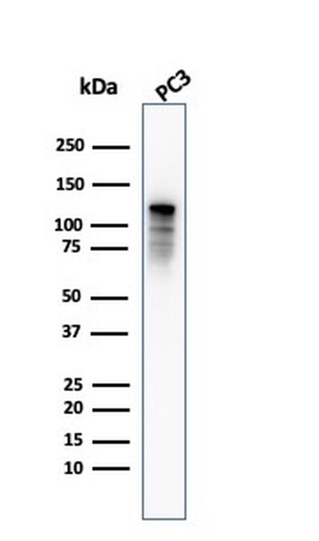 Drebrin 1 (DBN1) Antibody in Western Blot (WB)