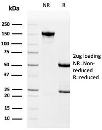 Drebrin 1 (DBN1) Antibody in SDS-PAGE (SDS-PAGE)