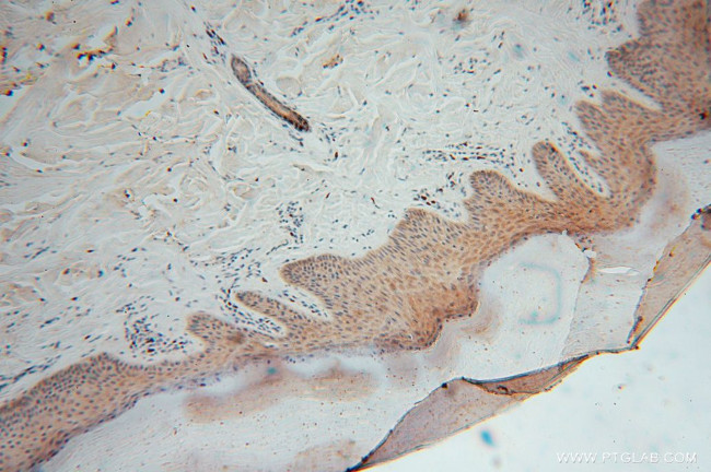 DHRS1 Antibody in Immunohistochemistry (Paraffin) (IHC (P))