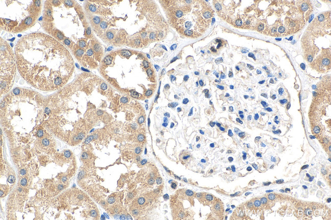 DHRS1 Antibody in Immunohistochemistry (Paraffin) (IHC (P))