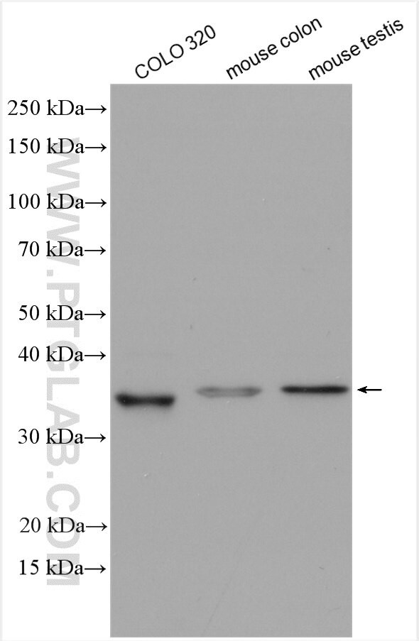 DHRS1 Antibody in Western Blot (WB)