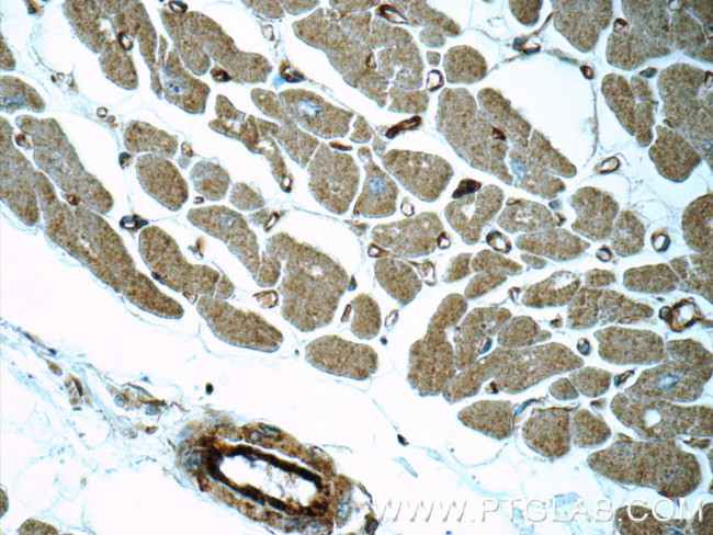 MYL12A Antibody in Immunohistochemistry (Paraffin) (IHC (P))