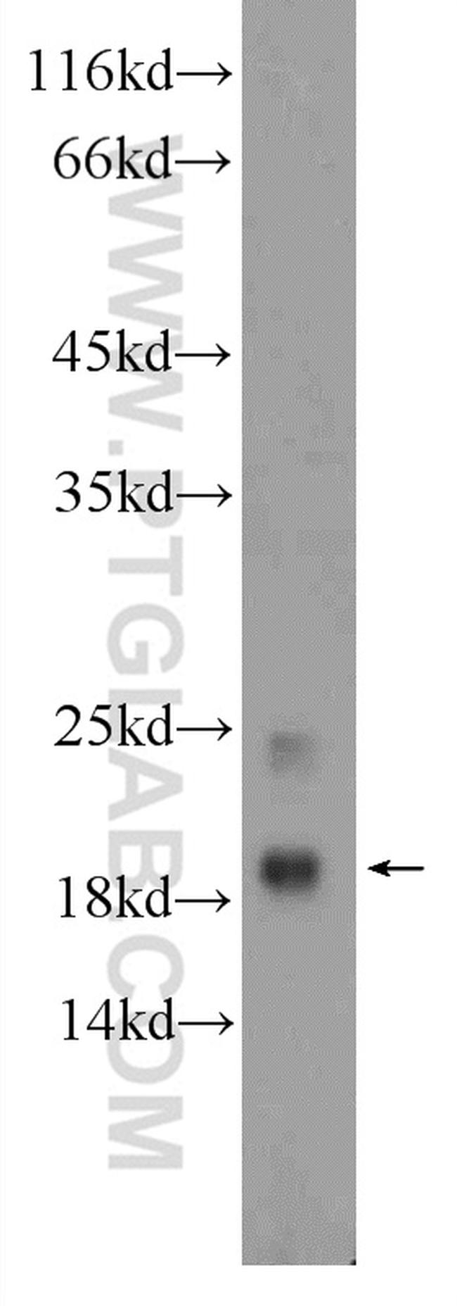 MYL12A Antibody in Western Blot (WB)