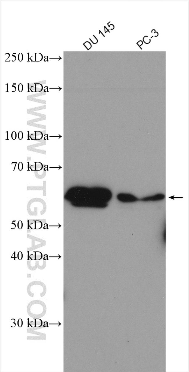 UAP1 Antibody in Western Blot (WB)