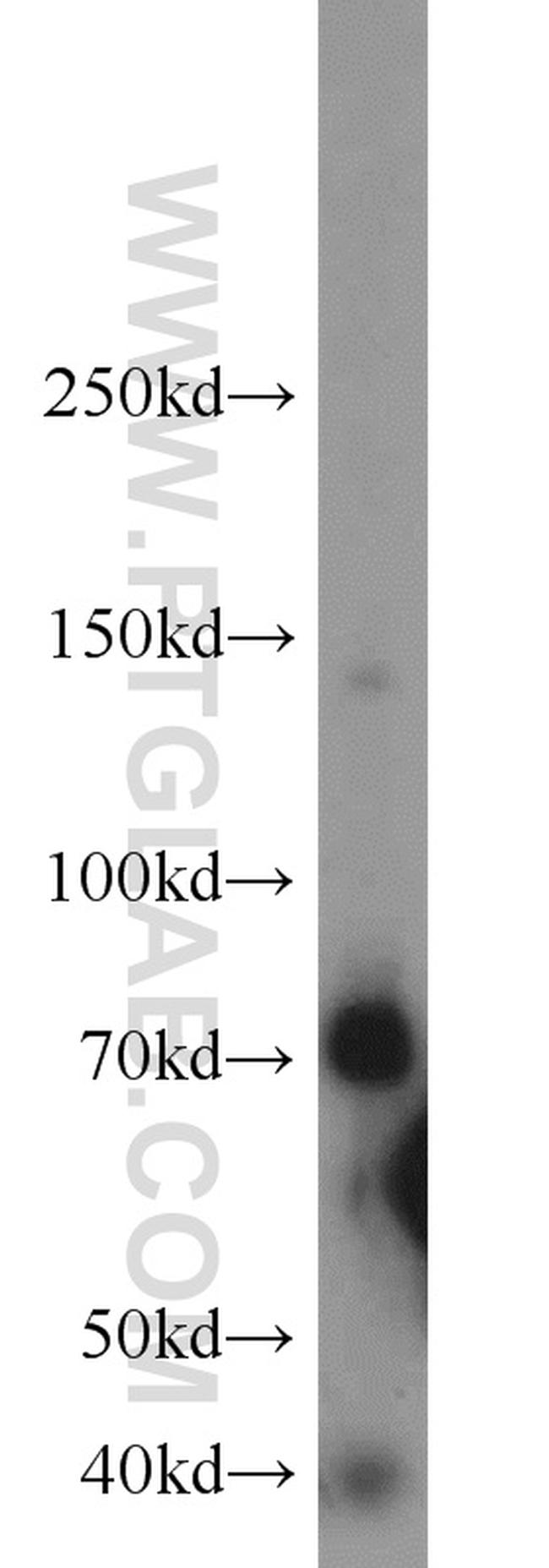 OCTN2 Antibody in Western Blot (WB)