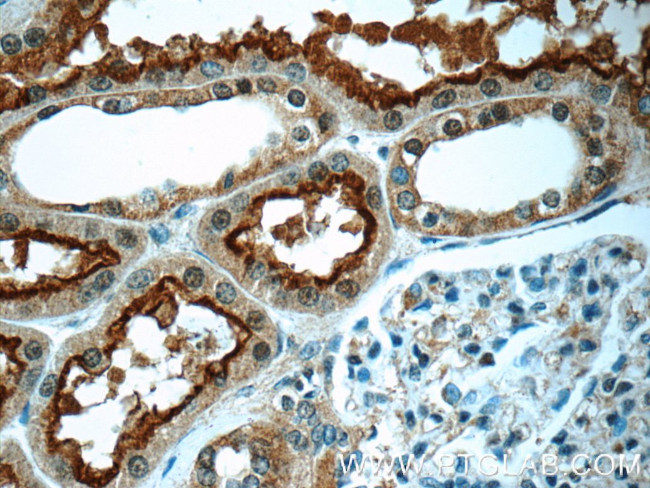 OCTN2 Antibody in Immunohistochemistry (Paraffin) (IHC (P))