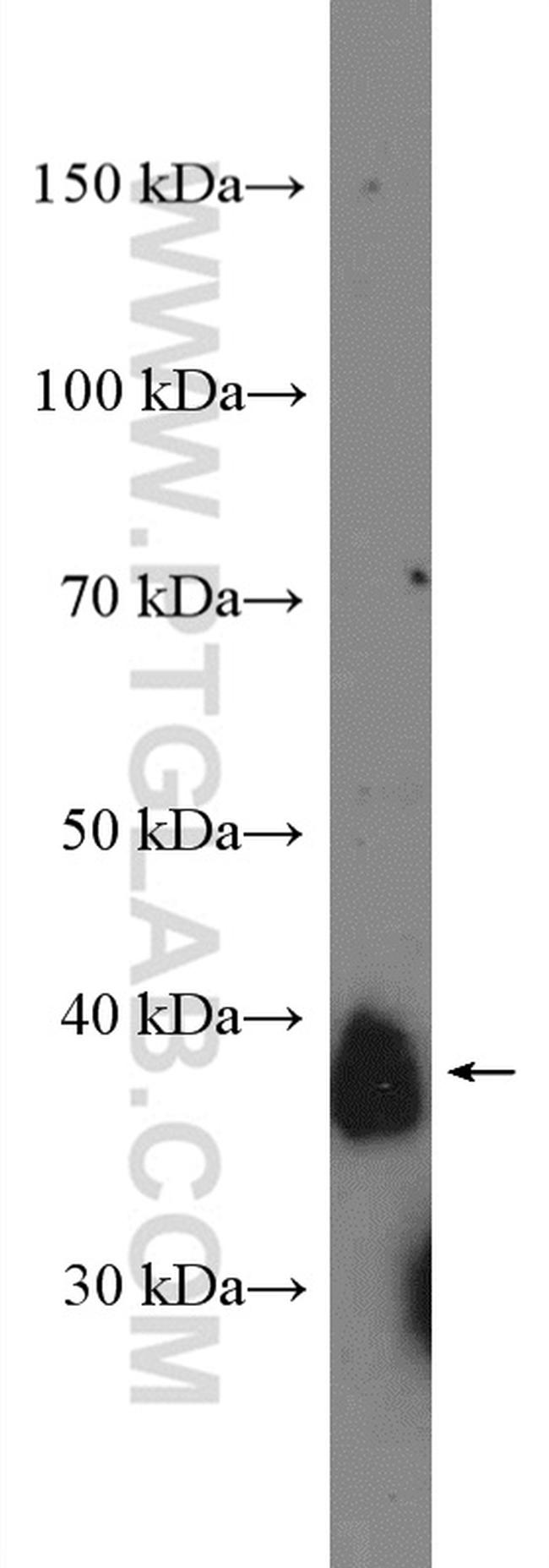 CD157 Antibody in Western Blot (WB)